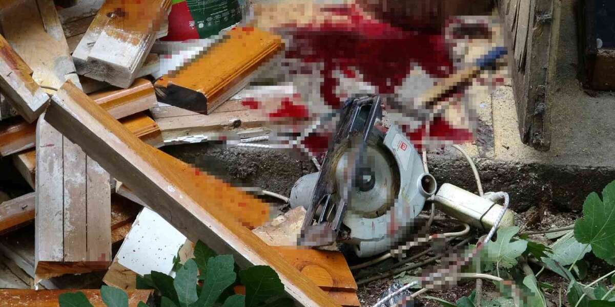 Elektrikli Testere Kazası: Yaşlı Adamın Bacağı Koptu, Torun Gözyaşlarına Boğuldu