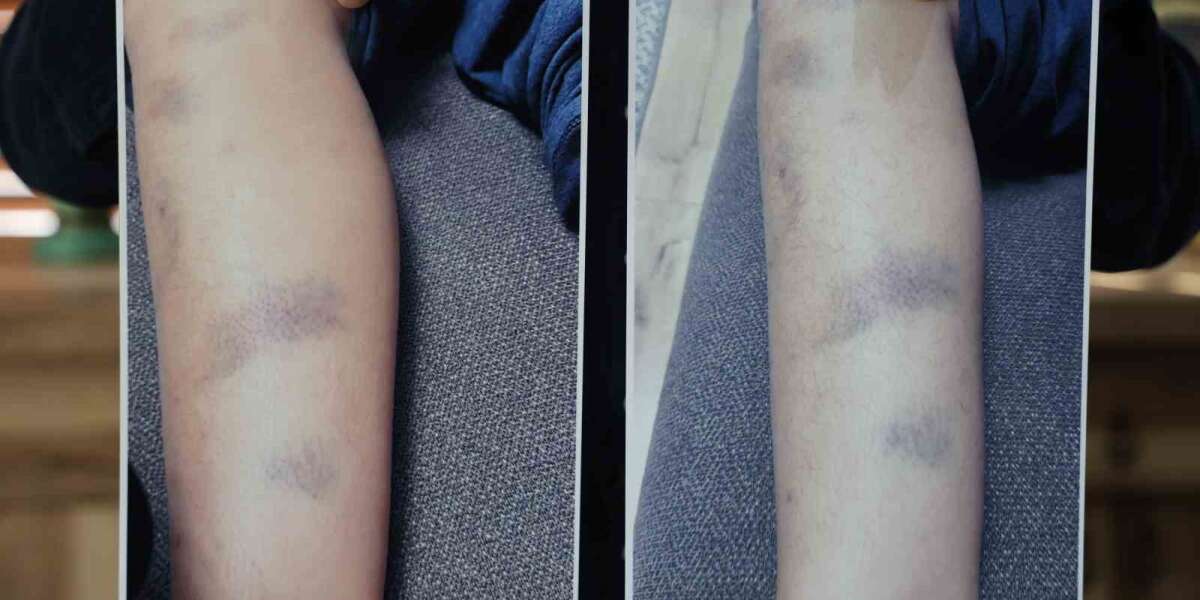 Özel Okulda Şiddet İddiası