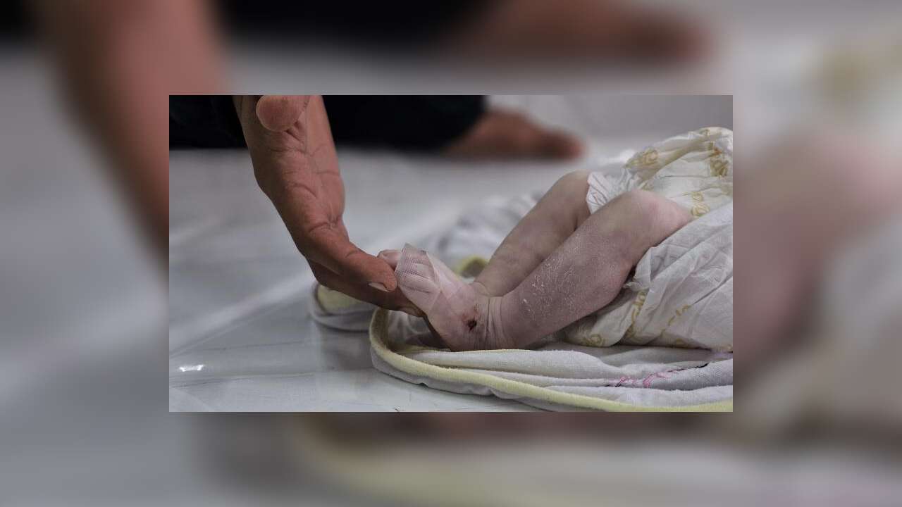 Gazze'de 2 Aylık Bebek Soğuktan Hayatını Kaybetti