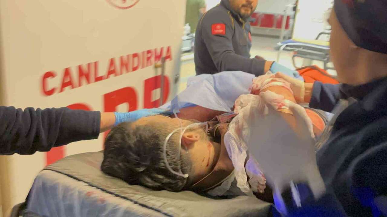 Yaşadığı Kadınla Tartışıp Cama Yumruk Attı Ağır Yaralandı