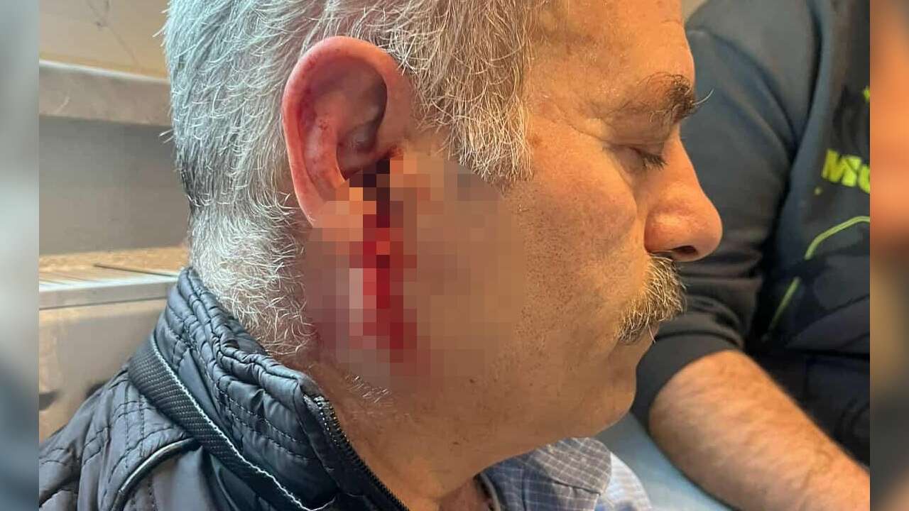 Eski Çalışan, Çıkış İşlemleri İçin Gittiği Özel Bakım Merkezinde Darbedildi