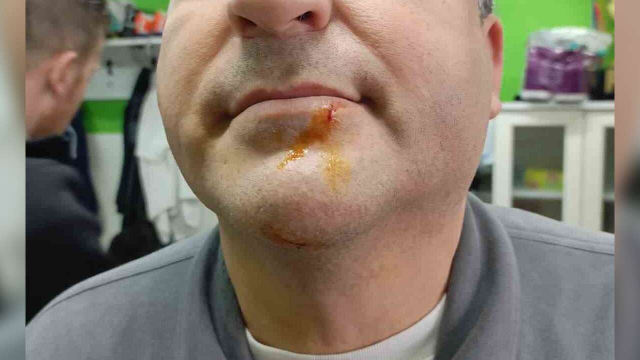 3. Lig Maçı Sonrası Gerginlik: 2 Gazeteci Darbedildi, 2 Polis Yaralandı