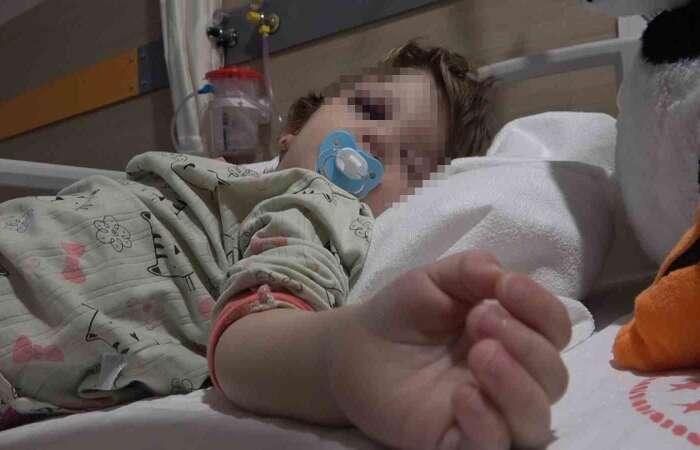 Gürültü Tartışması K*nlı Bitti: 14 Aylık Bebeğin Kafatası Çatladı