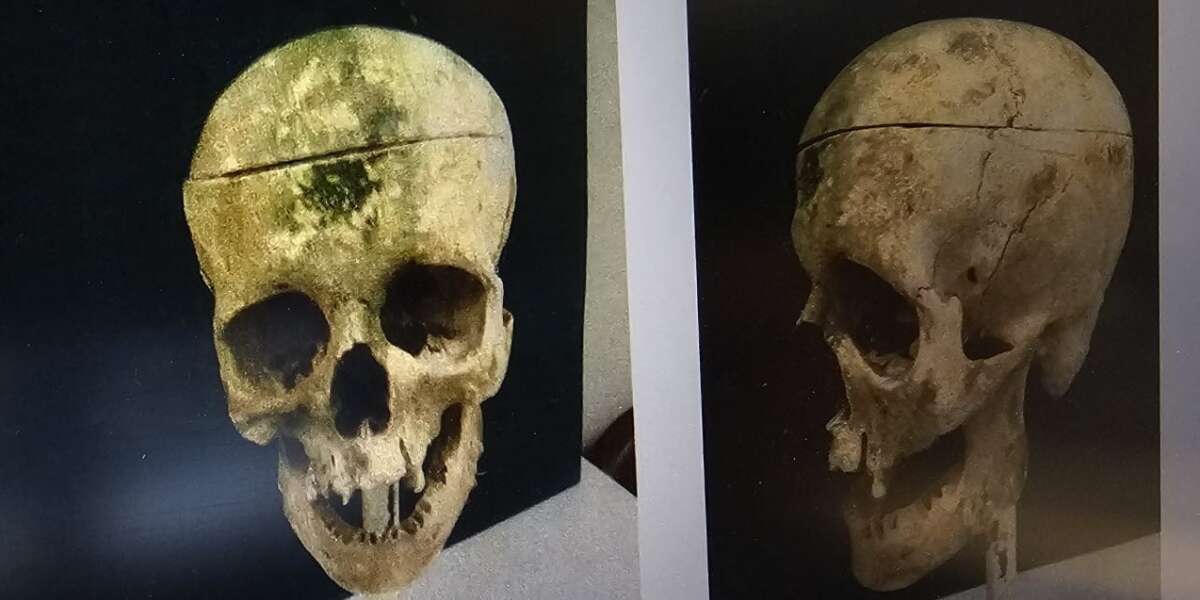 18 Yıllık Gizem Barajdaki Kemiklerle Çözüldü