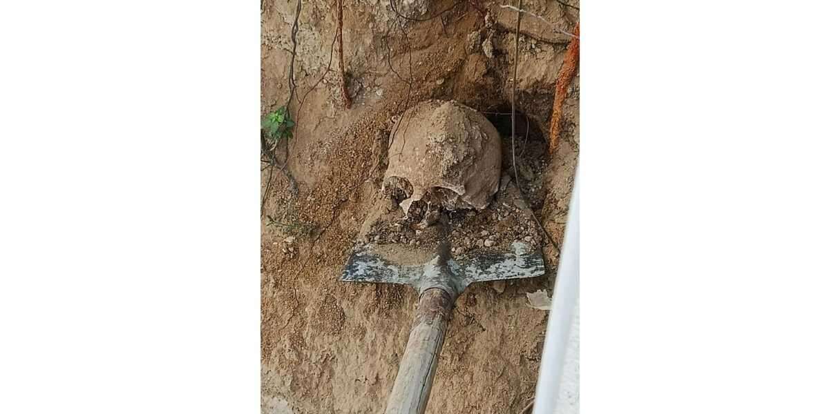 Bahçede Yapılan Kazıda İnsan Kafatası ve Kemikler Bulundu