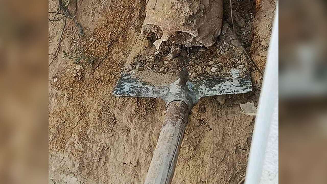 Bahçede Fidan Dikerken İnsan Kafatası Buldular: Site Sakinleri Tedirgin