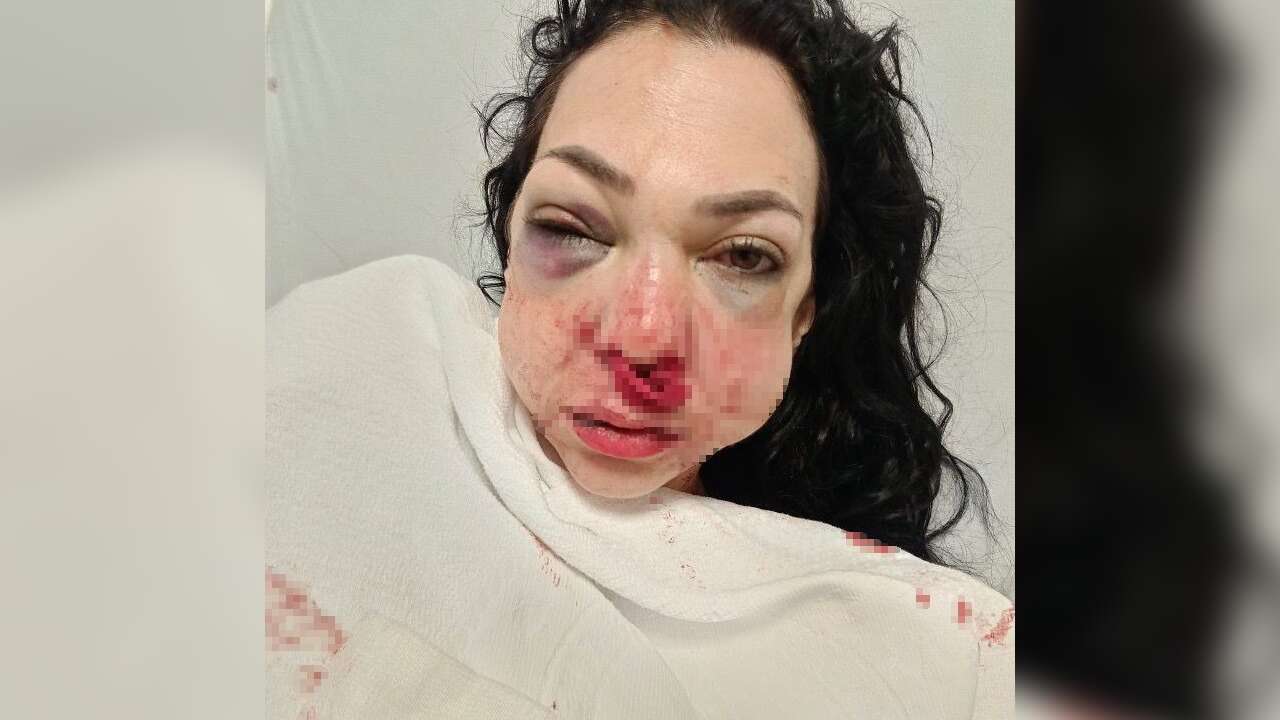 Bayramda Gittikleri Kafede Oğlunun Gözü Önünde Annesini Öldüresiye Dövdüler