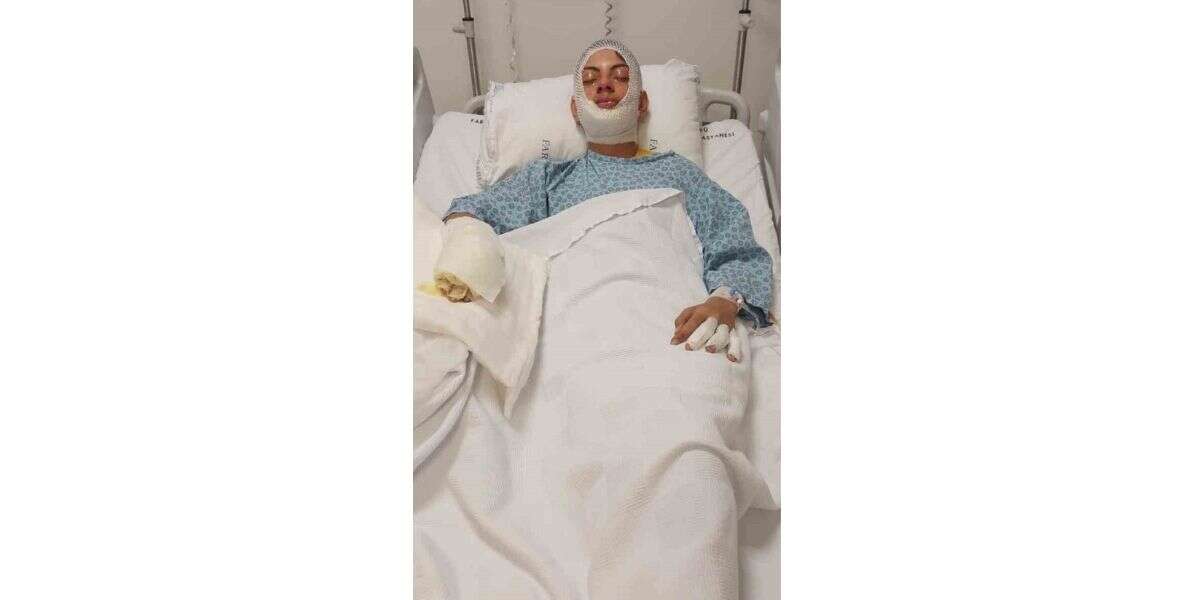 Ateşe Benzin Döktü, Saniyeler İçinde Kabusu Yaşadı