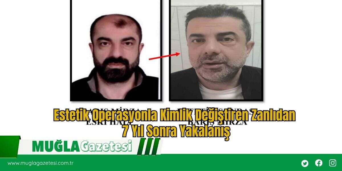 Estetik Operasyonla Kimlik Değiştiren Zanlıdan 7 Yıl Sonra Yakalanış