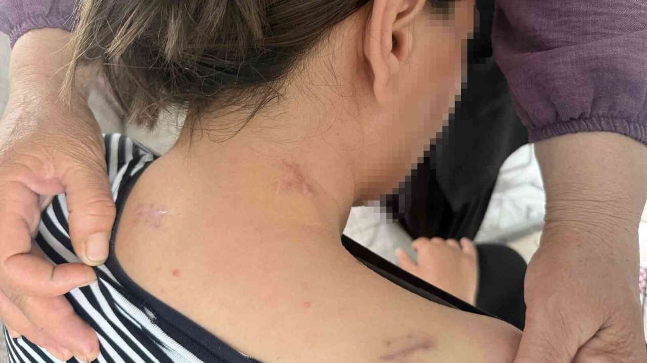 17 Bıçak Darbesiyle Ölümden Döndü: “Ölü Numara Yaparak Kurtuldum”