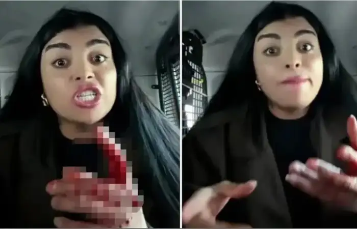 Tiktok Fenomeni Karagül’den Canlı Yayında Saldırı: Sokak Ortasında Kadını Bıç*kladı