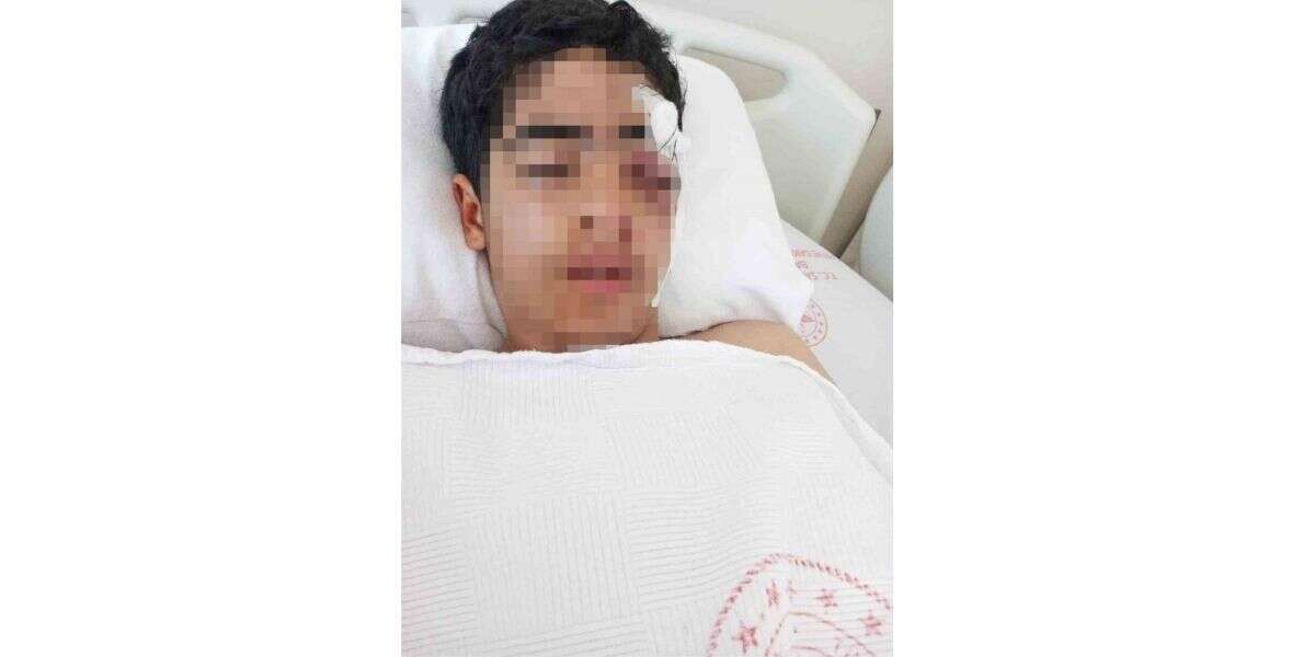 Akran Zorbalığı: 15 Yaşındaki Çocuk M*ştalı Saldırıyla Ağır Yaralandı
