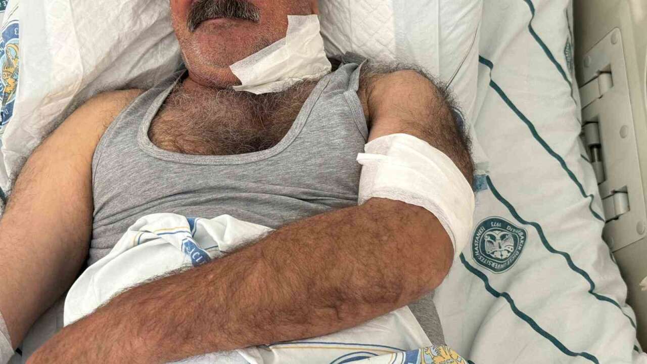 At Sahibini Boğazından Isırdı: Adam Ağır Yaralandı