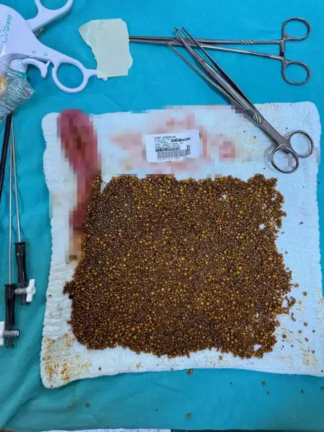 karin-agrisi-sikayetiyle-gitti-safra-kesesinden-19307003-4854-m